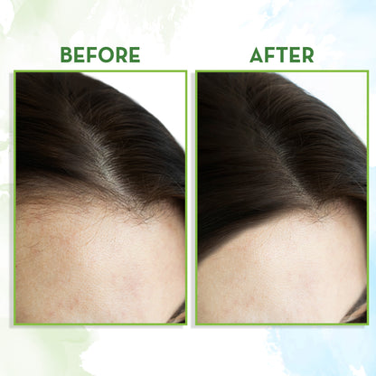 rosemary essential oil for hair growth