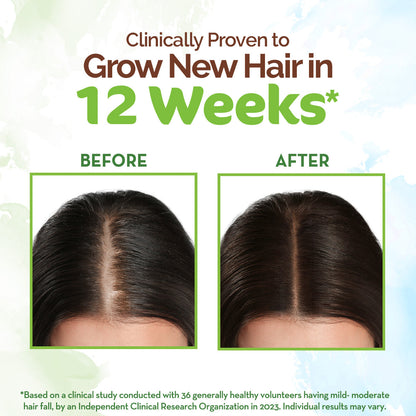 Mamaearth Rosemary Hair Growth Oil