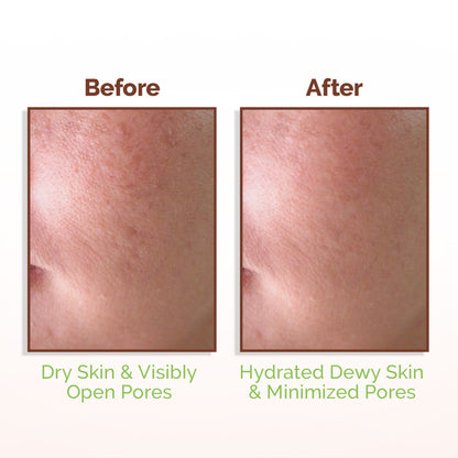 Mamaearth Rice Water Dewy Face Toner 150 ml