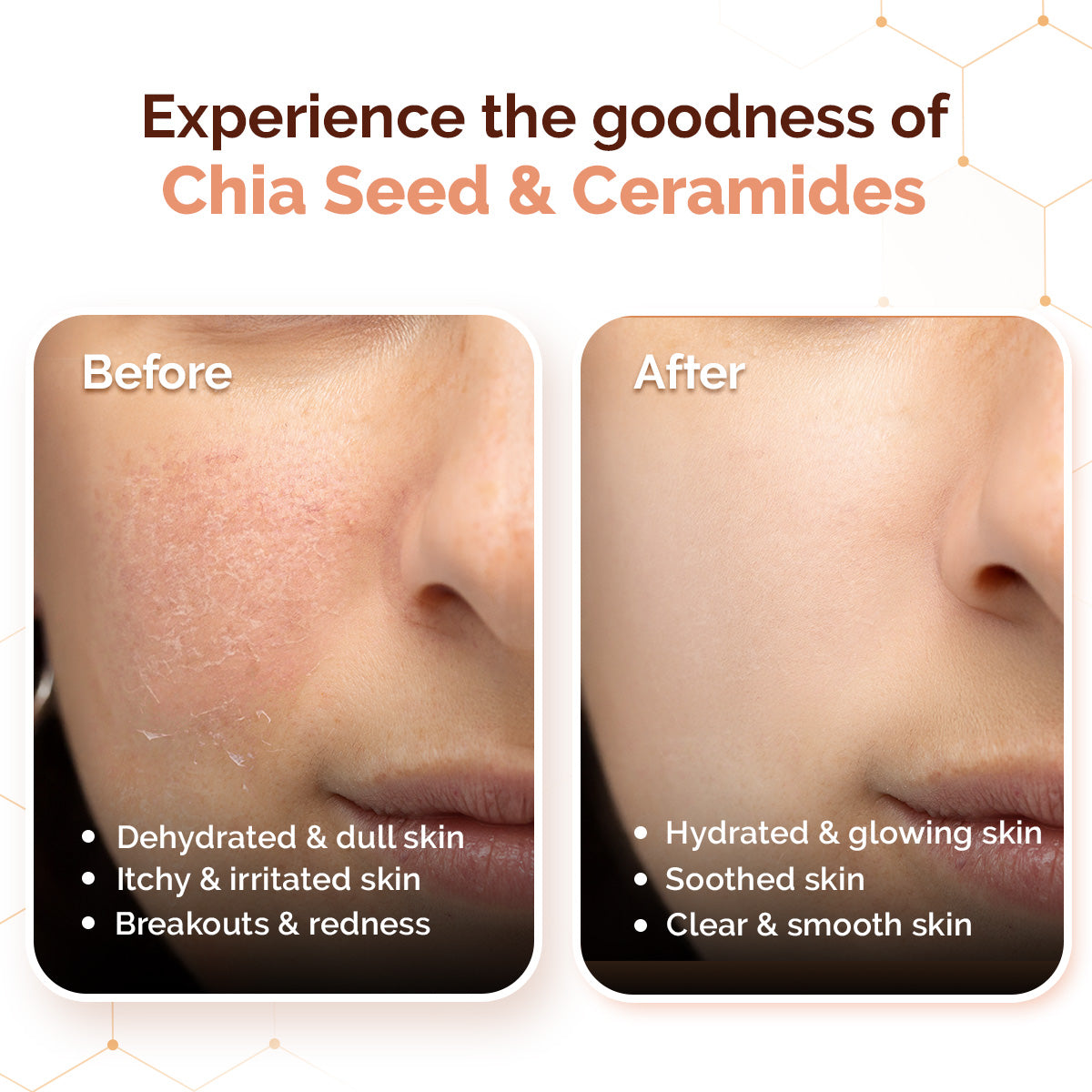 Chia Oil-Free Moisturizer